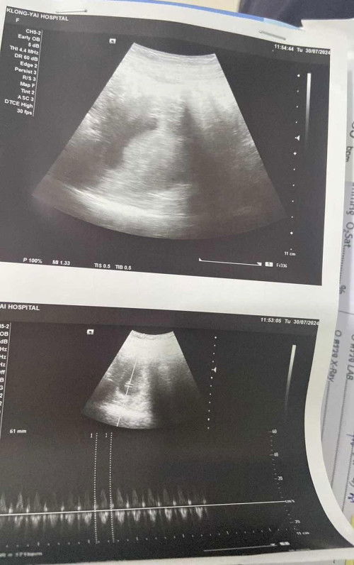 ท้อง8week ยังไม่พบเด็ก