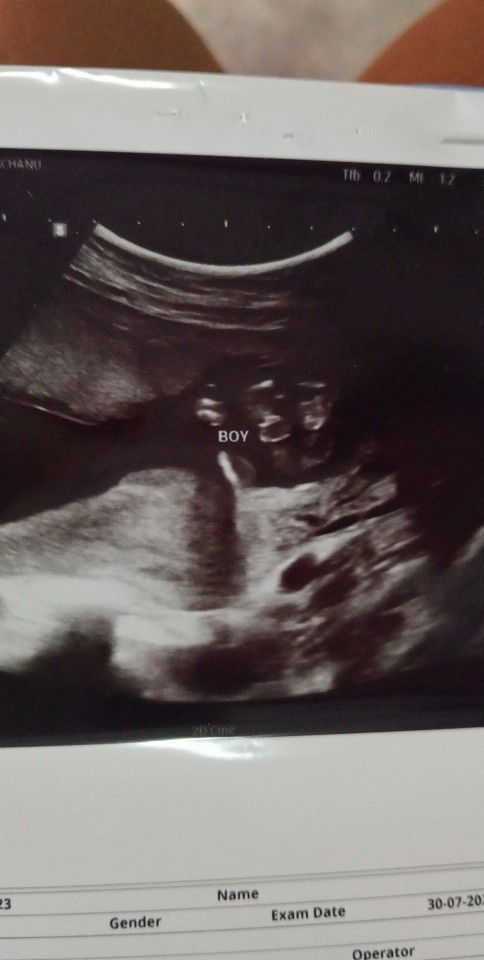 เพศลูกหญิงหรือชาย