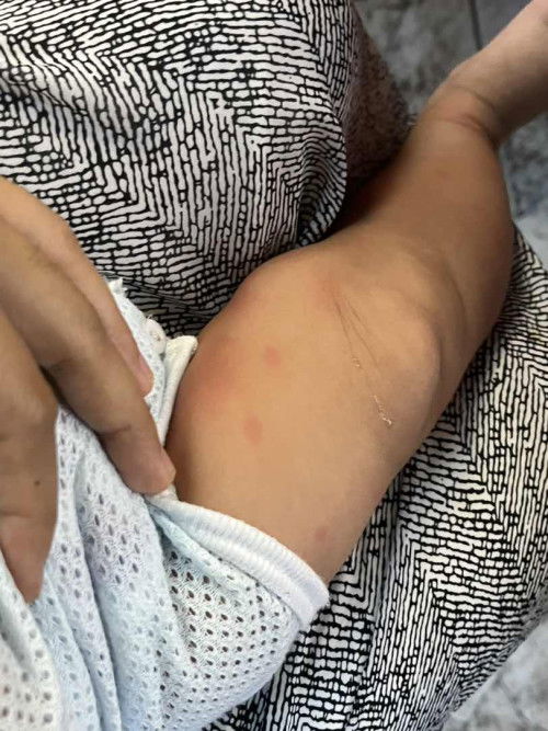 Bintik2 bdn baby 5bln