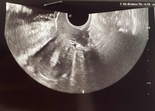 False positive atau terlalu awal