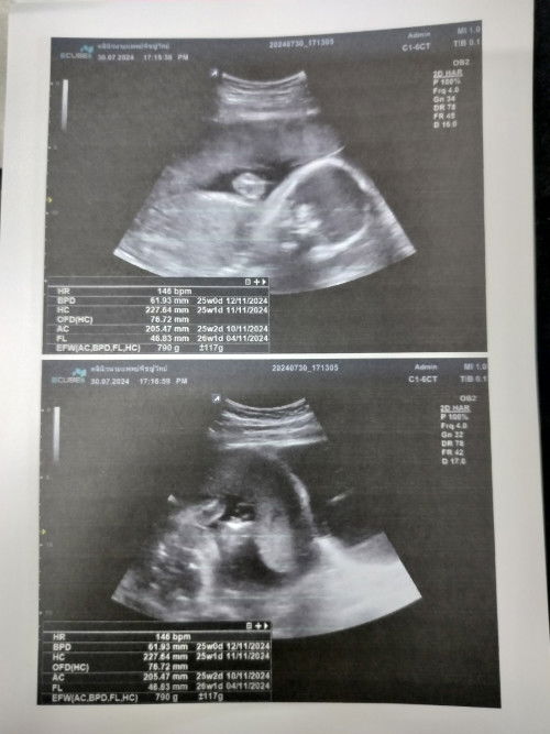 มาแชร์กันค่ะแม่ๆ❤️❤️