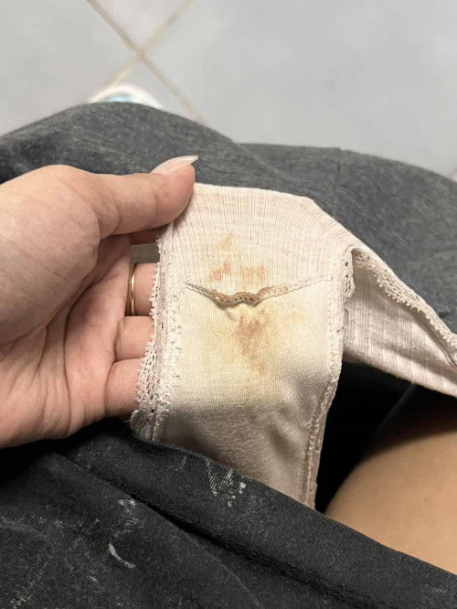 ประจำเดือนยังไม่มา