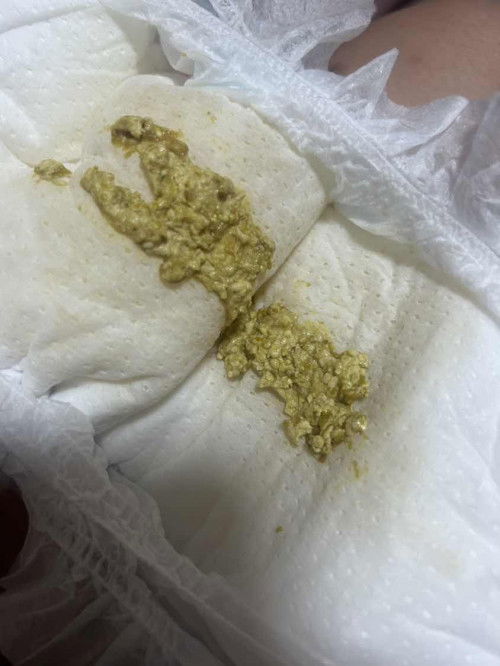 น้องถ่ายแบบนี้ผิดปกติไหมคะ