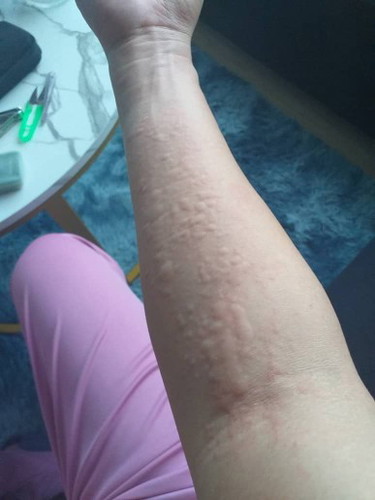 Ubat / cream for gatal gatal