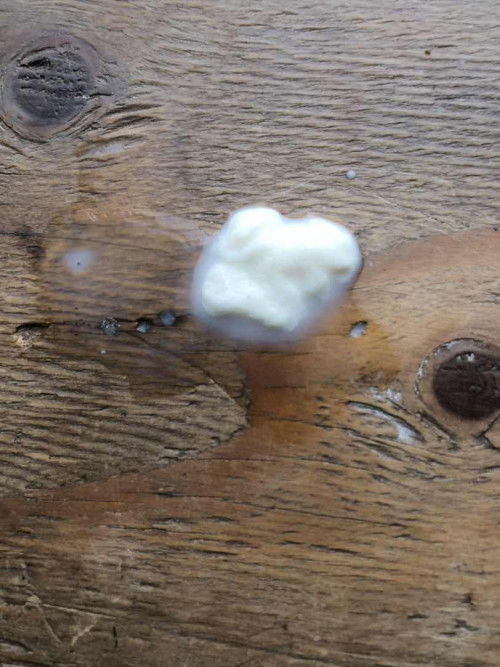 สายปั้มนม สอบถามแม่ๆมีก้อนในน้ำนม