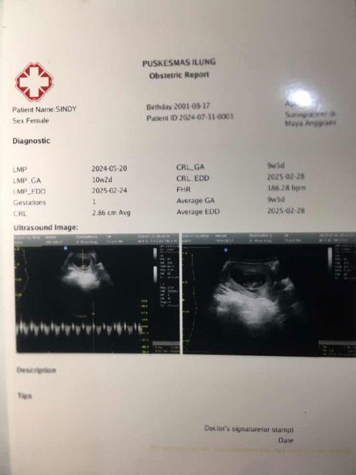 Usia kandungan 10w2 di usg 9w2d