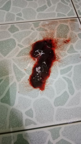 แบบนี้จะแท้งไหม