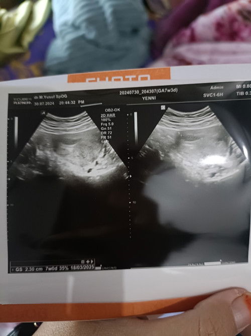 7 Minggu masih kantung