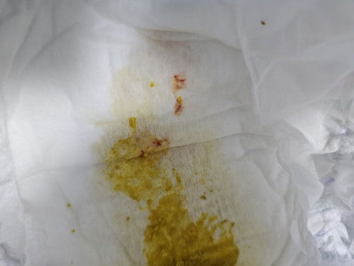 ลูกถ่ายแบบนี้อันตรายไหมคะ