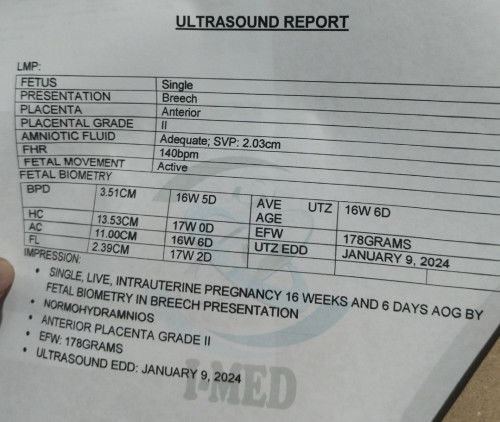 What do you think boy or girl?