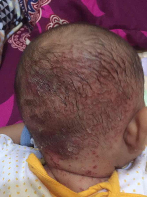Mohon bantu kasih solusi bunda atau ada yg sama seperti ini sembuh di kasih apa