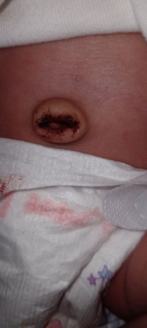 ขอสอบถามแม่หน่อยคะ