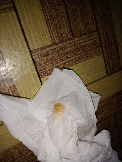 Maaf bund agak nggak sopan dan jorok tpi mau tnyak nihh...