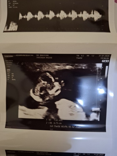 Screaning DS di 13weekk