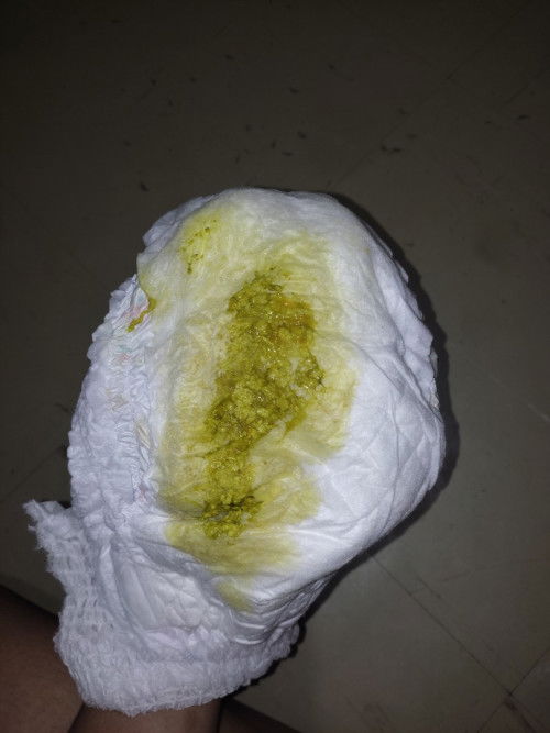 สอบถามเเม่ๆหน่อยค่ะน้อง2เดือน16วัน กินนมแม่ อึเเบบนี้ปกติไหมค่ะ