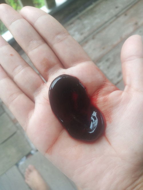 ใช่ถุงตั้งครรภ์ไหมคะ