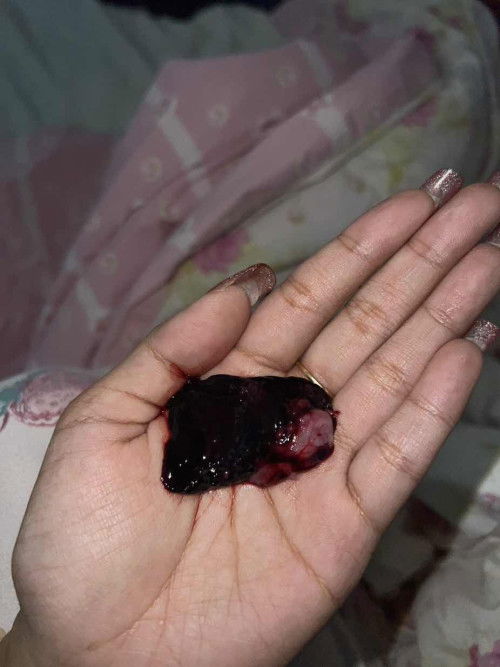 เป็นความเสียใจที่ยังคงรอคอยเขากลับมาอยู่ตลอด