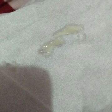 4 week kluar cairan agak kehijauan gini aman ga Bun??