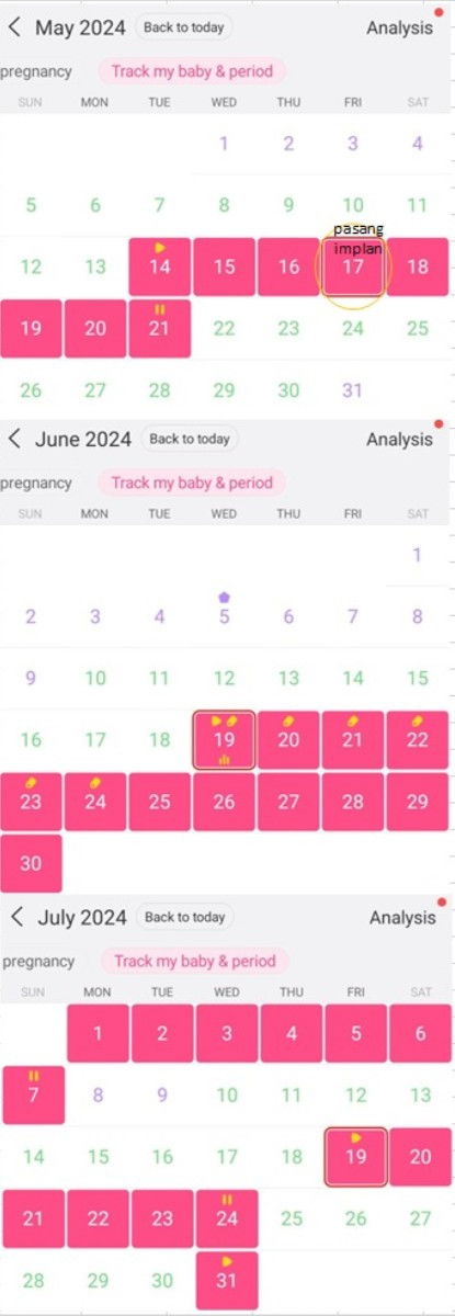 Efek samping KB implan