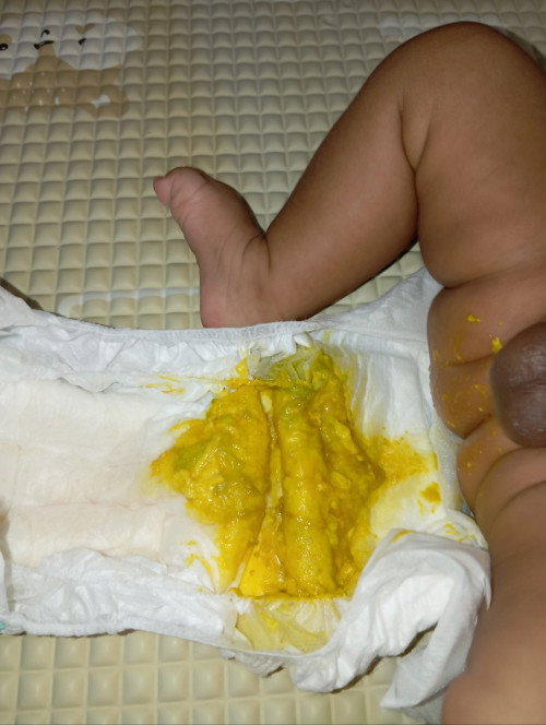 BAB bayi kuning ada sedikit hijau