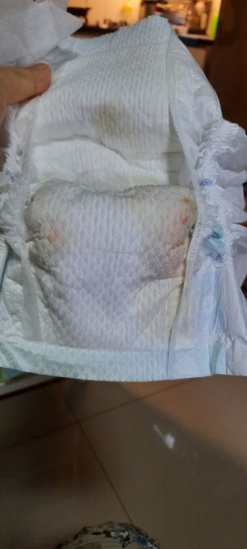 Anak saya cowo baru lahir juli 27 kmrin kalau pipis kayak ada darahnya apakah ini bahaya atau tidak