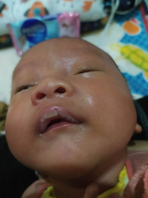 Bibir kering pada bayi