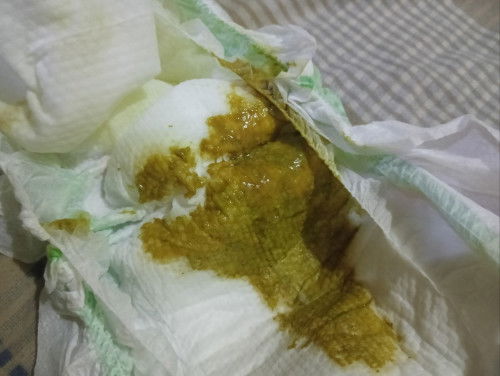 Normal po ba sa 3months old na ganyan ang poops at 3 times a day? Formula fed po sya