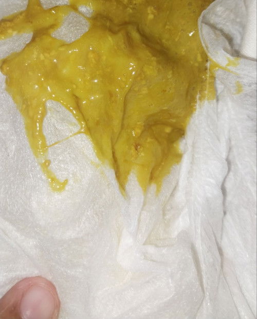 BAB BAYI 2 BULAN 20 HARI