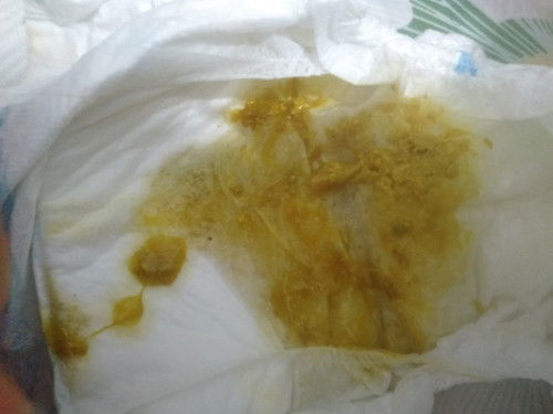 Bab bayi normal atau tidak