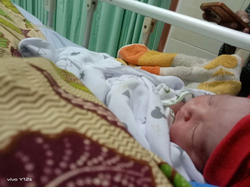 Tindakan induksi + SC