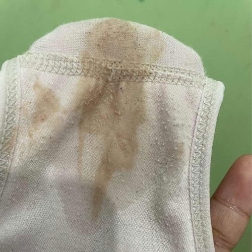 Keputihan atau flek, maaf jijik