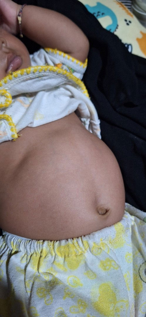 Gejala/ normal ya bun pernafasan bayiku,,