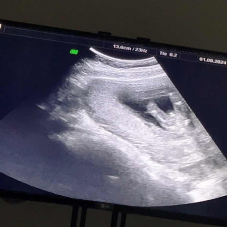 แม่ๆรู้เพศลูกกันตอนกี่สัปดาห์ค่ะ