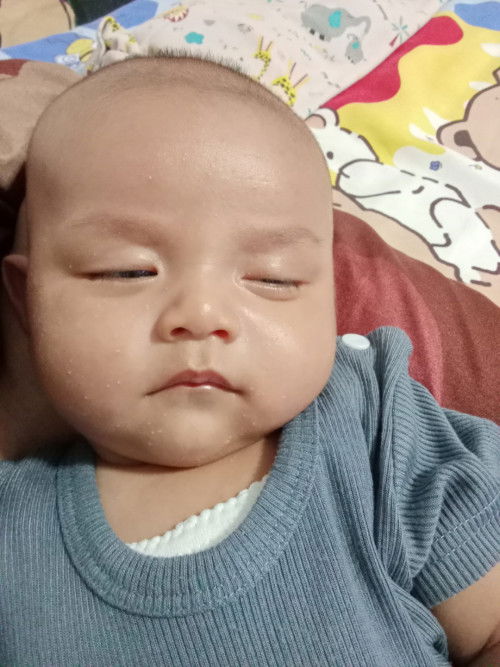 Mulia di muka bayi