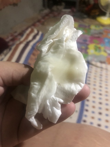Mucus plug napo kaya ito??