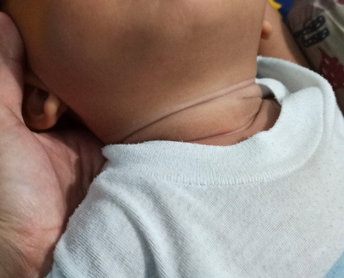 Kulit belang