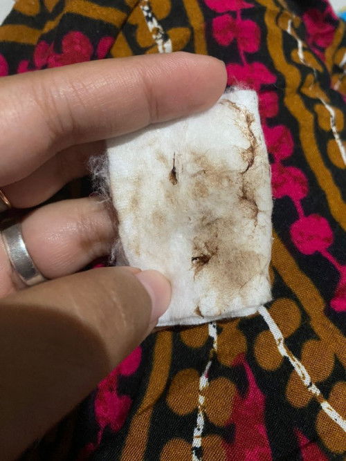 Keluar lendir coklat di usia 7 week