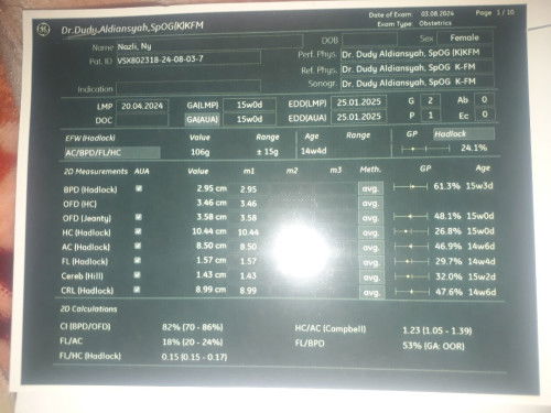 Bingung liat hasil usg