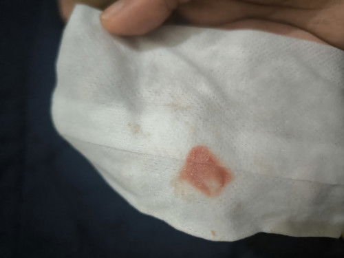 แบบนี้อันตรายไหมคะ