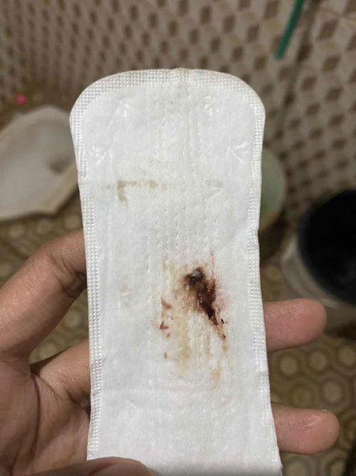 Flek 4minggu jalan 5minggu