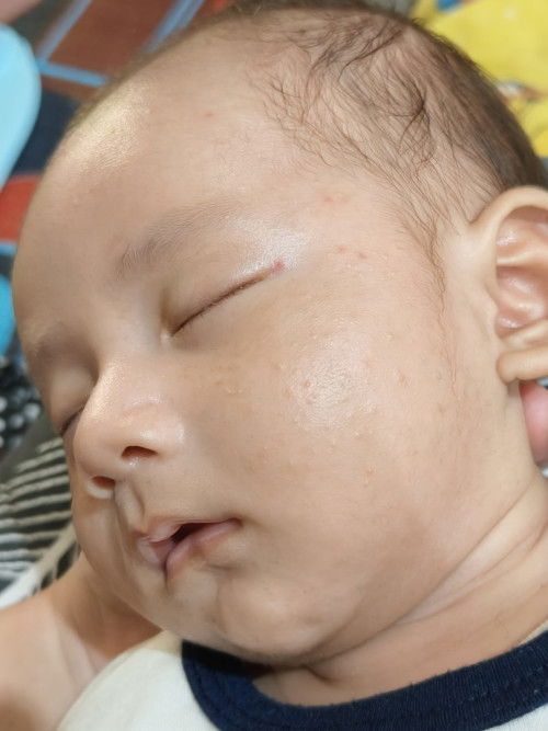 wajah bintik-bintik putih & merah