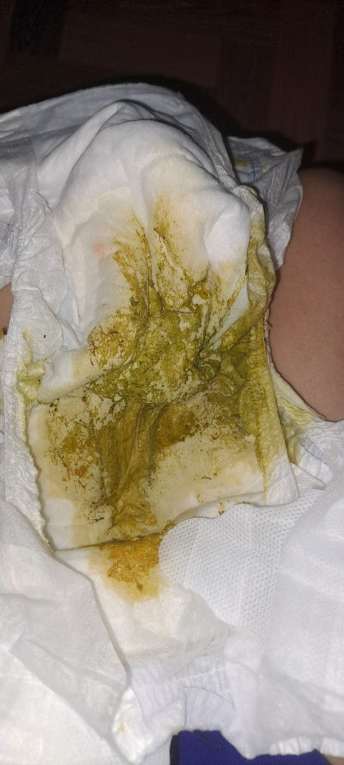 Bigla humina sa paginum sa bote si lo. Nangyayari po ba tlga to dti nkaka apat na bote si lo .