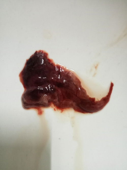 สอบถามแม่ๆหน่อยค่ะ