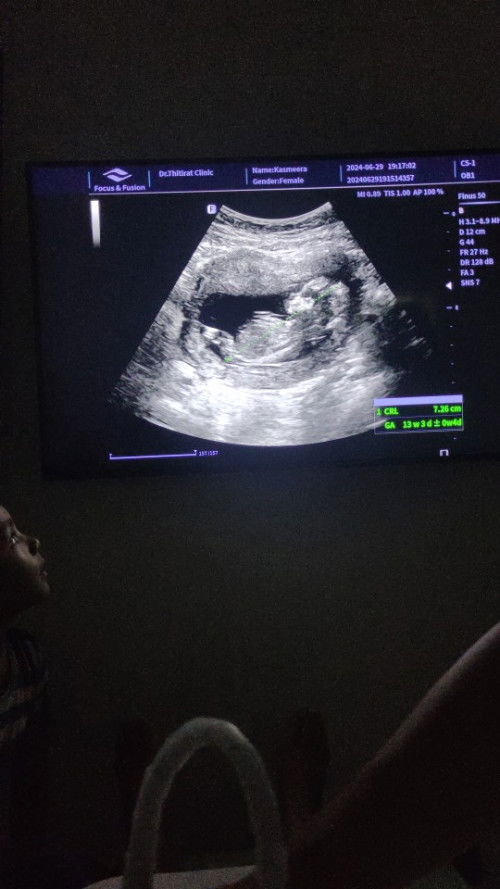 อายุครรภ์เดือนเห็นเพศได้ยังนะ