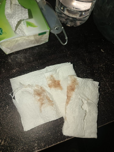 Brown discharge