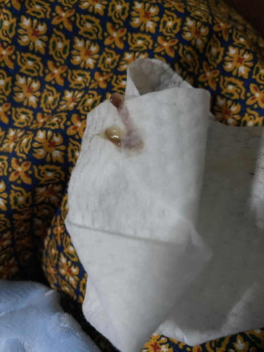 แบบนี้ปกติมั้ยคะ