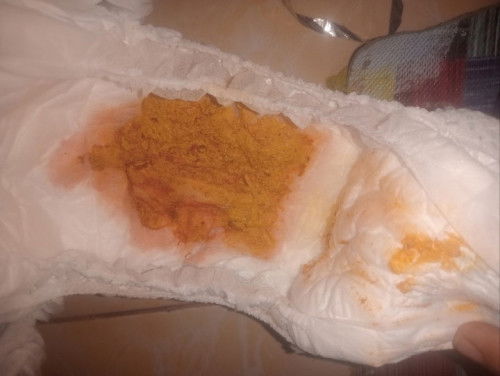 Tolong info ya Bun tolong kasih jawaban Bun🙏🙏.