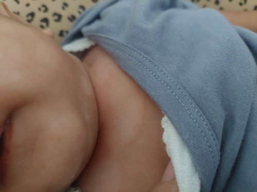 Kulit tidak sama rata