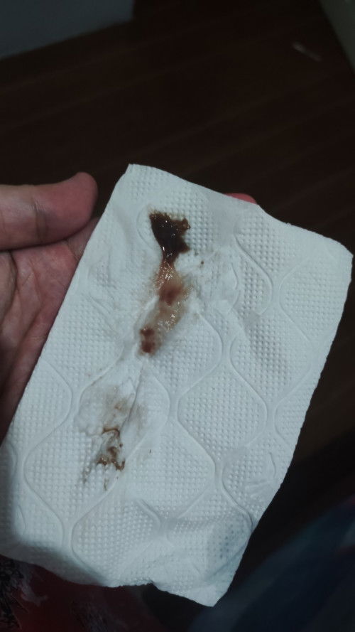 BROWN DISCHARGE (Currently 37 weeks pregnant)