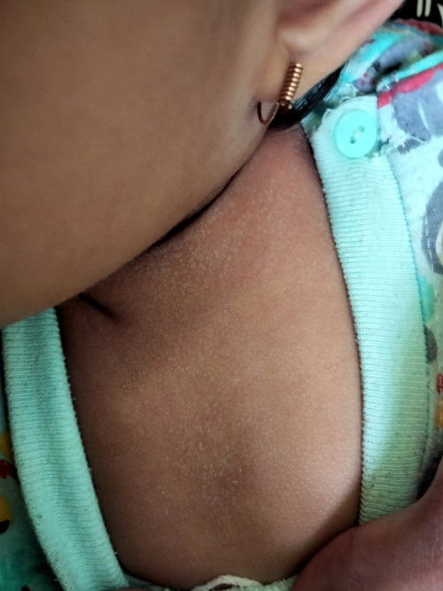 Saran Dong Bunda Pakein Apa Biar ga gini, kya kering terus sering gatal.. seleher penuh.. tlg bantu(